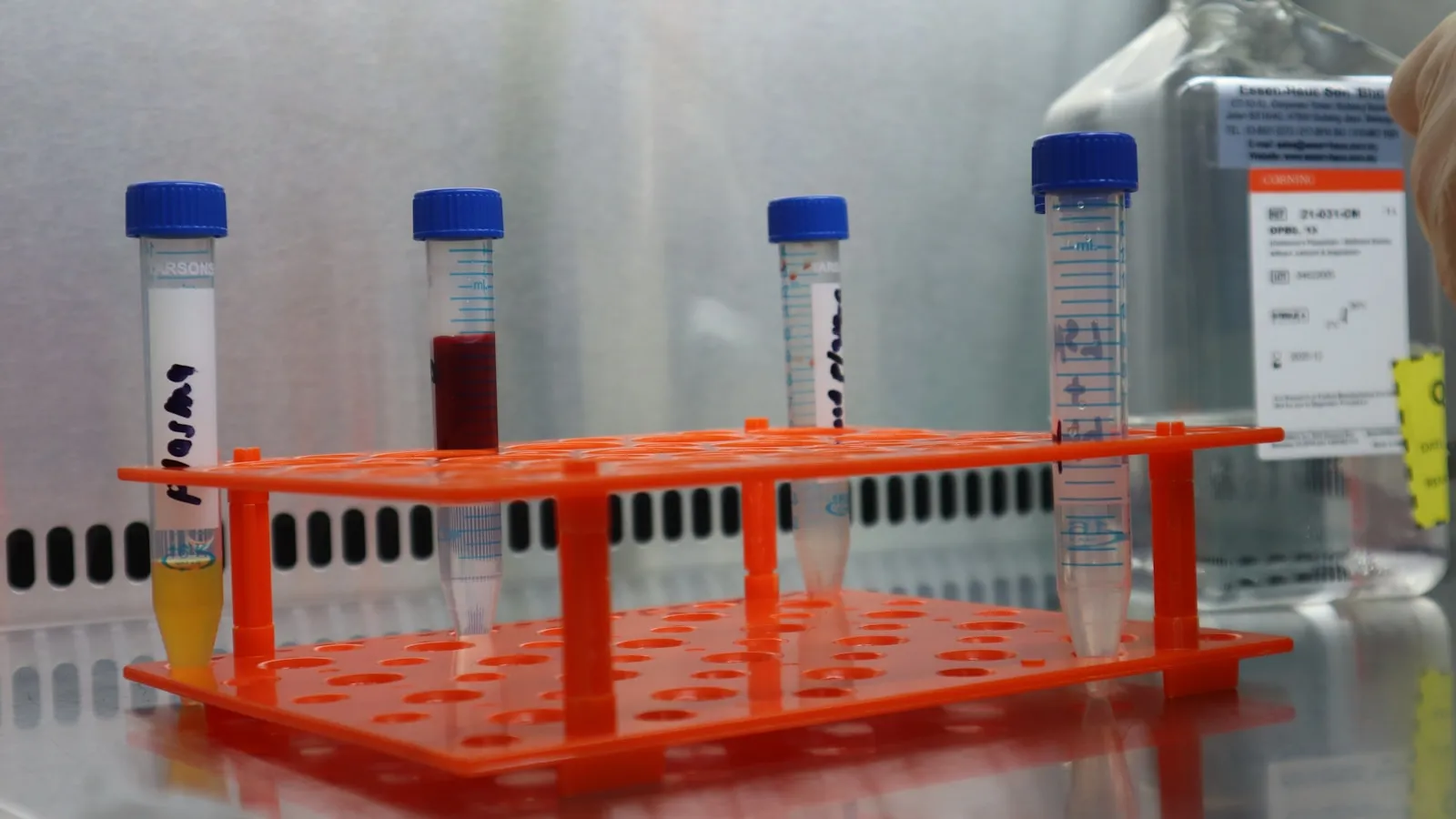 Rek met gelabelde buisjes met bloedplasma in een laboratorium.