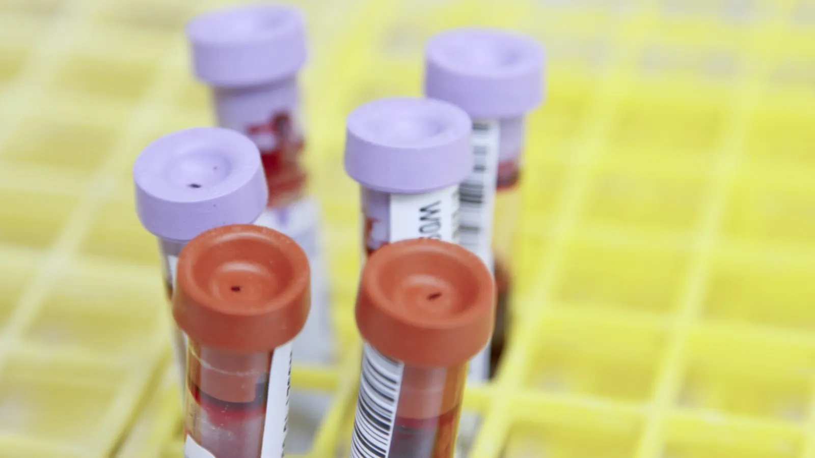 How long is methadone detectable?
